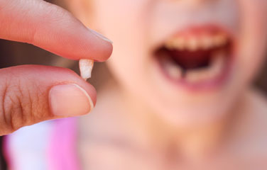Farmacias Similares, Importancia de la dentadura temporal